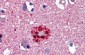 TCF21 antibody - N-terminal region